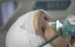Маленькому ребенку из Китая пересадили череп, напечатанный на 3D-принтере