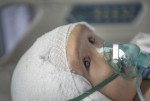 Маленькому ребенку из Китая пересадили череп, напечатанный на 3D-принтере