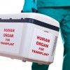Organ-Transplant-Case-100x100