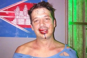 В Камбодже избили британского туриста за татуировку на лбу