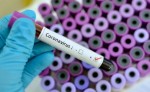 За 6 недель в Китае зафиксировано рекордное число новых случаев заражения коронавирусом